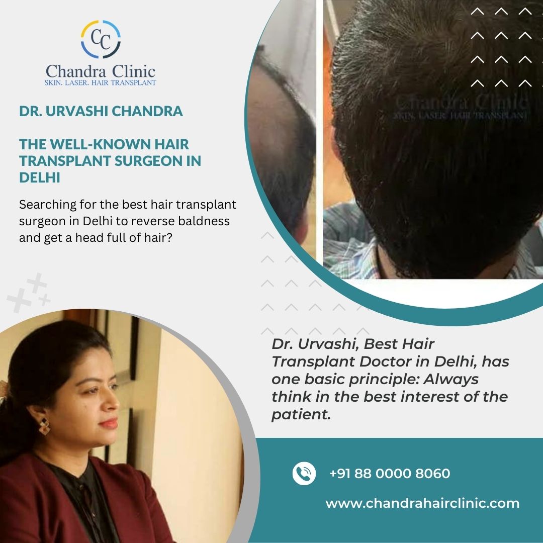 Dr. Urvashi Chandra: The Well-Known Hair Transplant Surgeon in Delhi –  